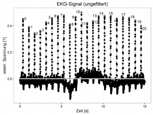Beispiel_EKG-Signal